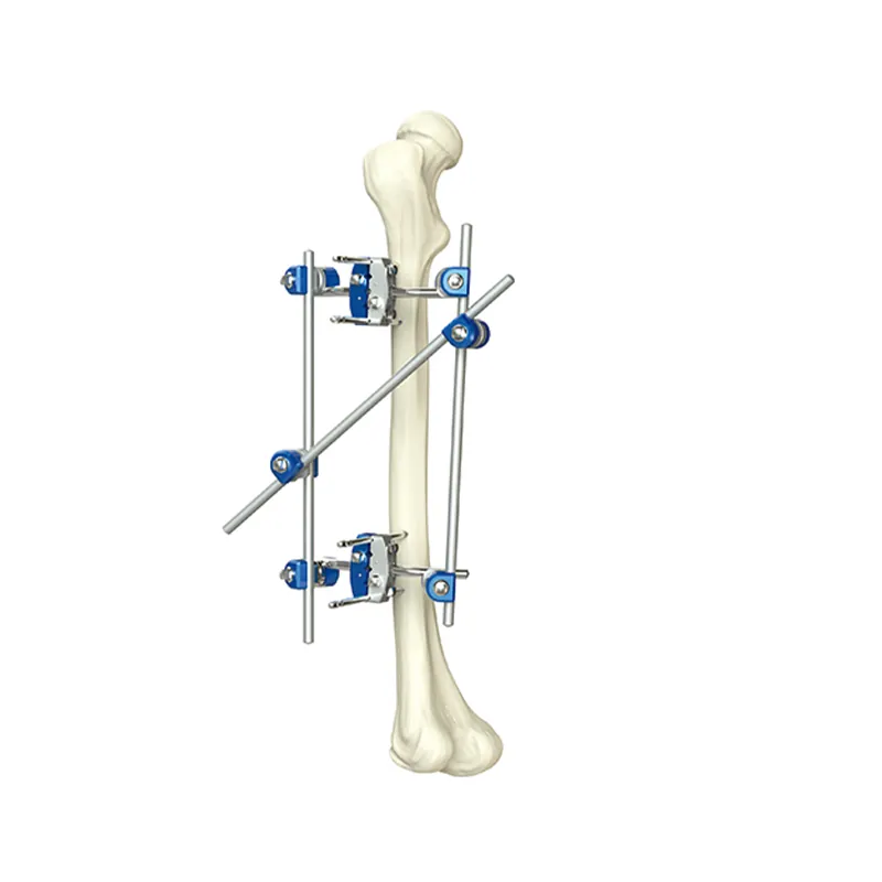 half ring external fixator