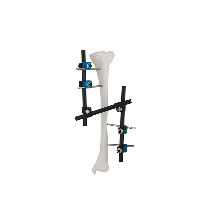z type enhancement mode external fixator