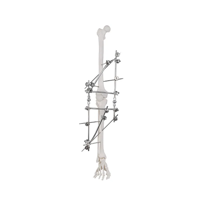 knee joint external fixator 9100 2701
