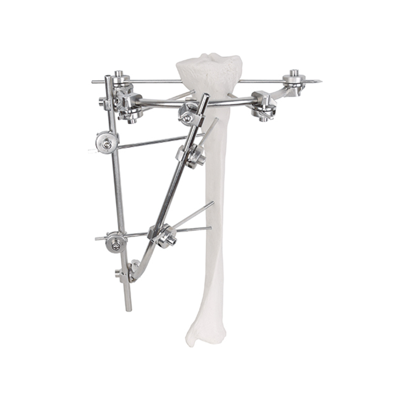 tibial plateau frame external fixator