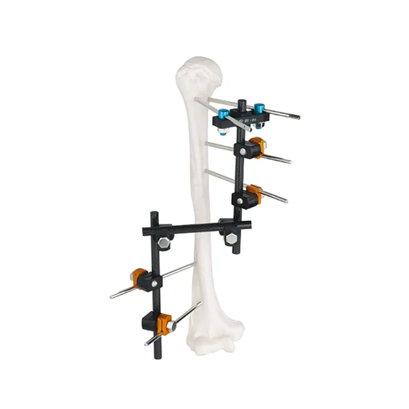 z frame t type external fixator