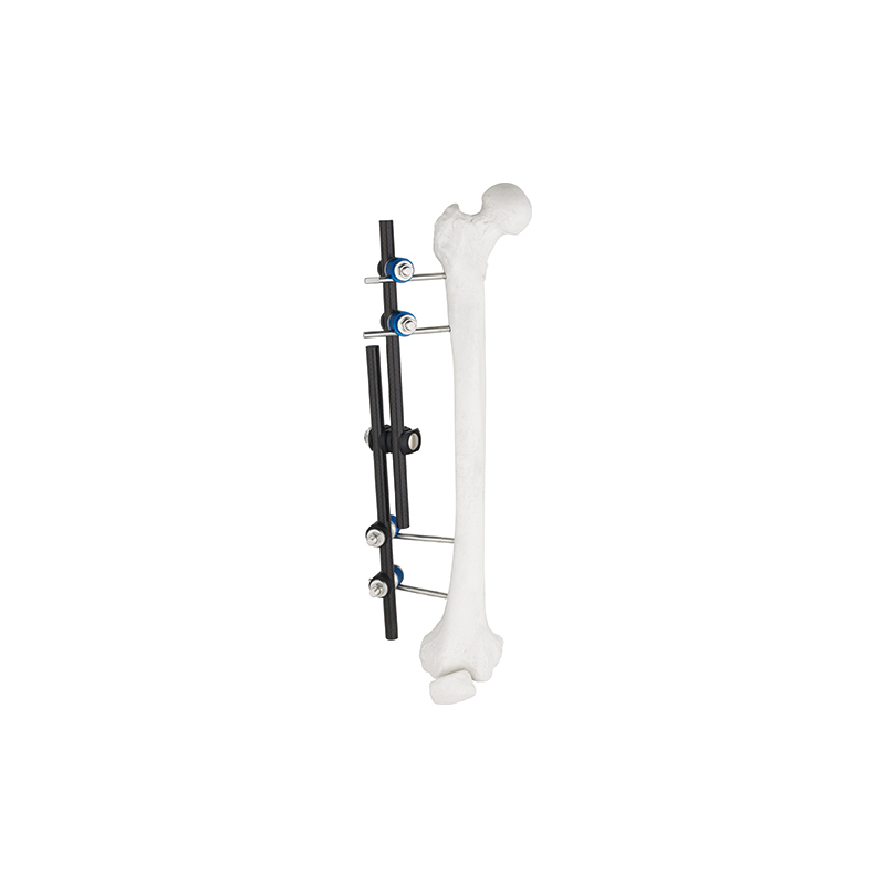 straight type external fixator 8100 10
