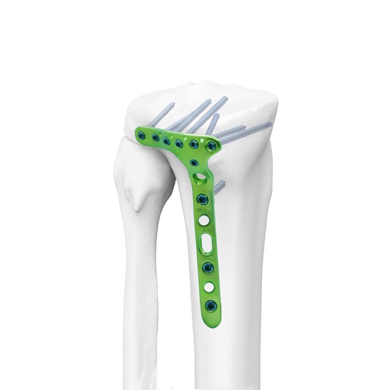 distal lateral tibial locking plate ii