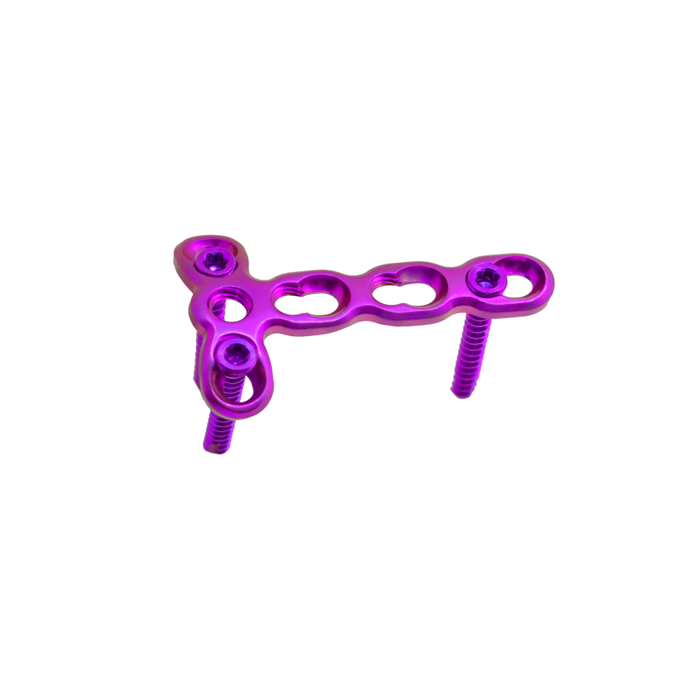 2 0 mm mini t locking plate