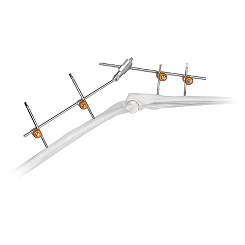 elbow joint external fixator