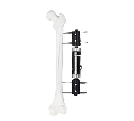 dynamic axial straight type external fixator