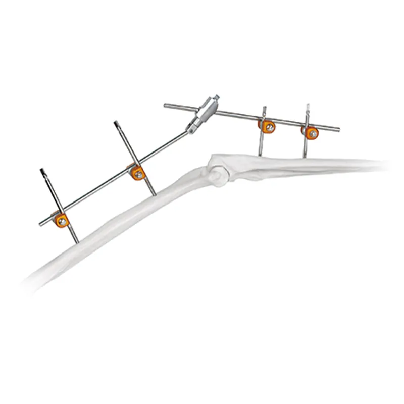elbow joint external fixator