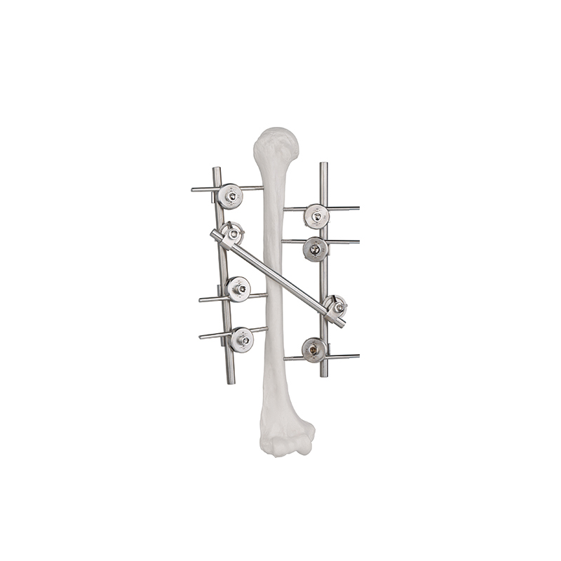 humeral frame external fixator