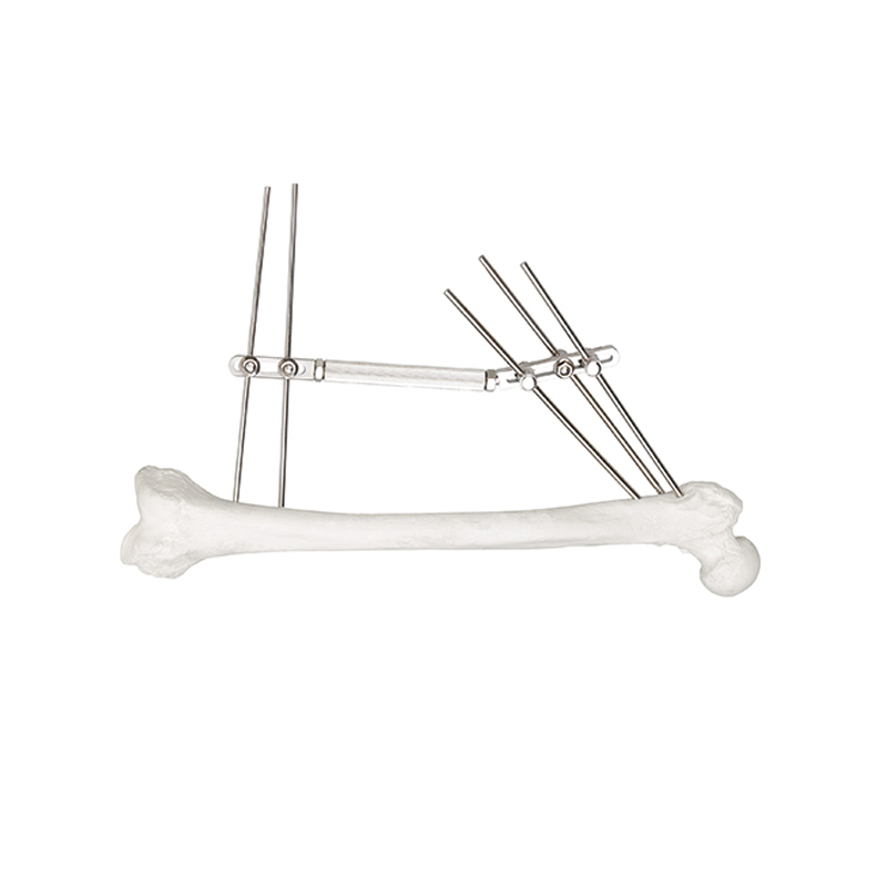dynamic external fixator