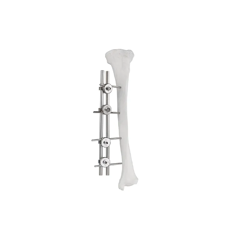 double rod single side external fixator