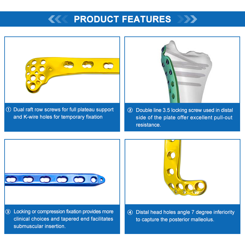 proximal lateral tibial locking plate i