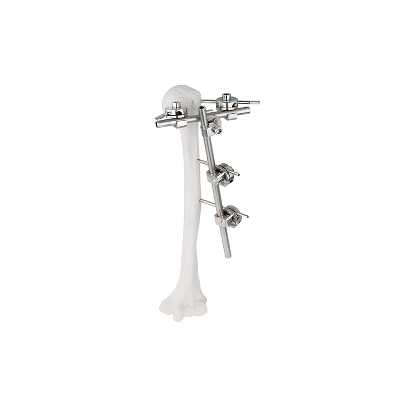 humeral lateral condylar neck external fixator