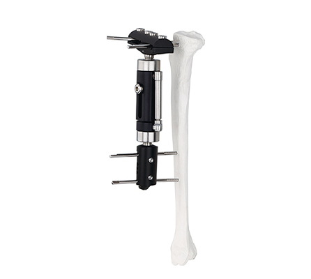 dynamic axial proximal femoral fragment external fixator