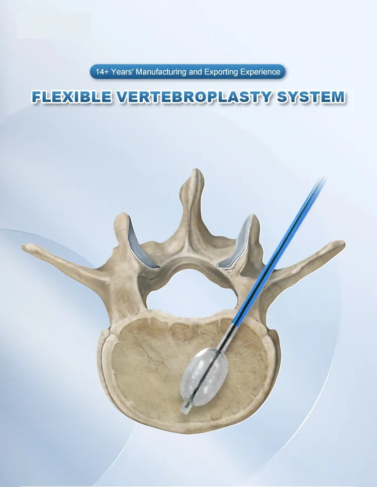 joint bone cement