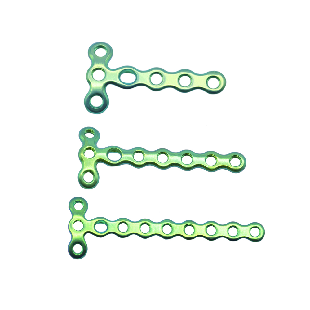 1 5mm mini condylar locking plate