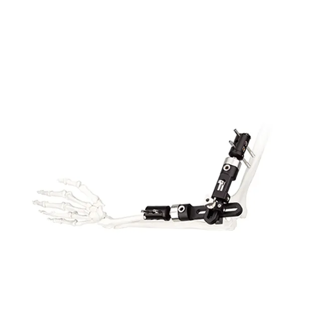 elbow fragment external fixator