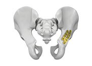 2 0mm cortical screw square head