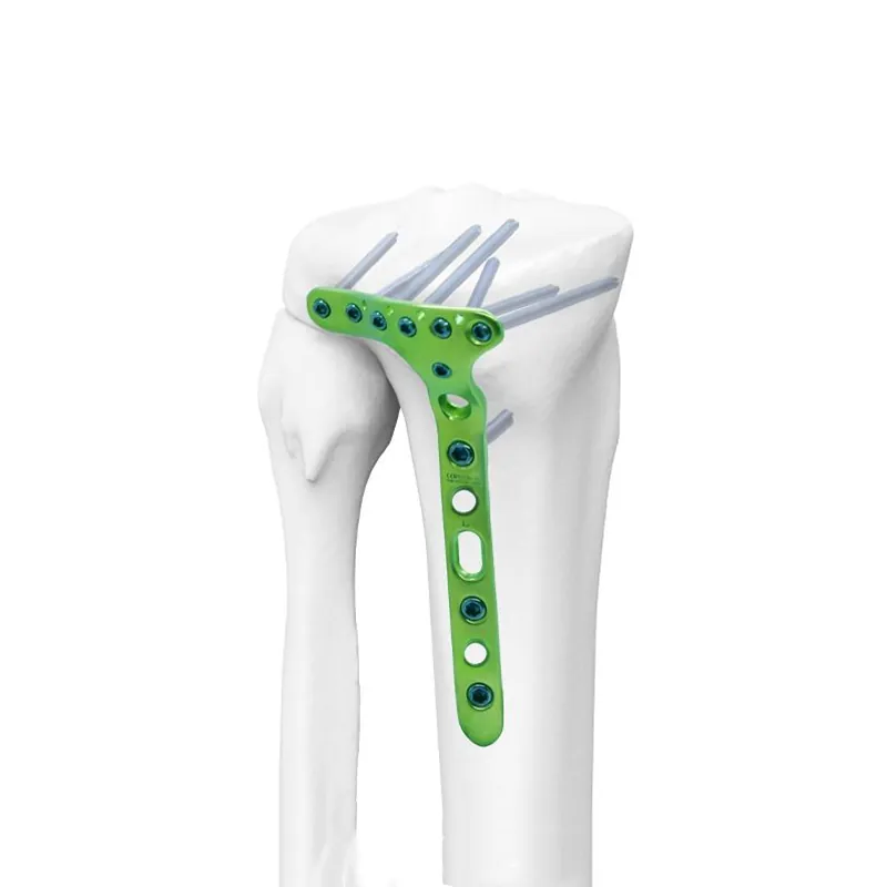 distal lateral tibial locking plate ii