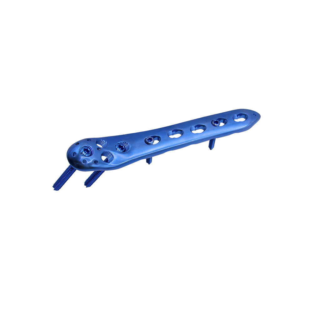 proximal femoral locking plate ii