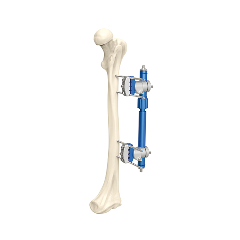 micro motion type external fixator 7100 21