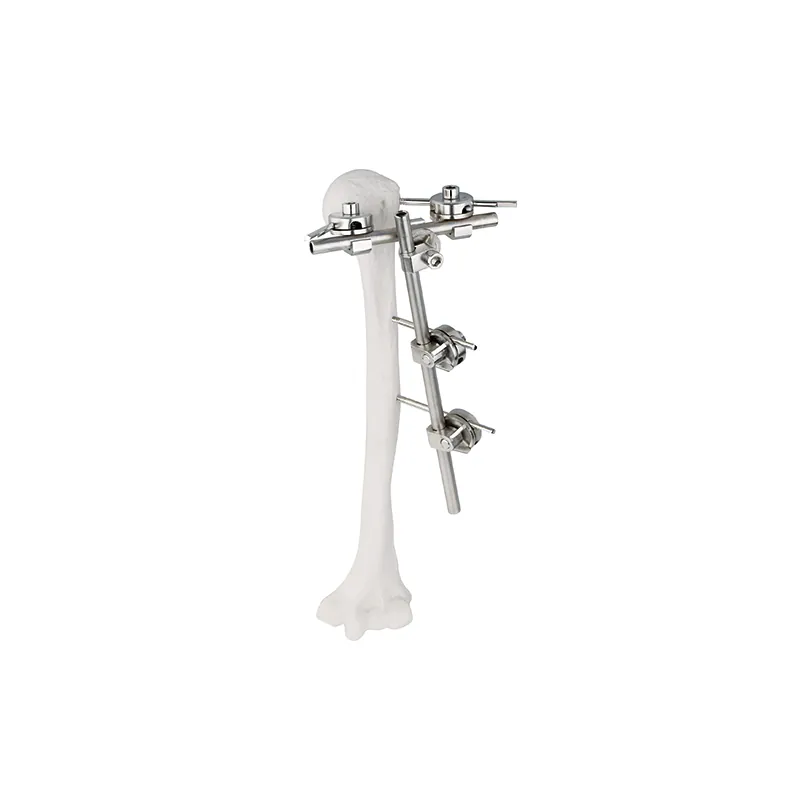 humeral lateral condylar neck external fixator