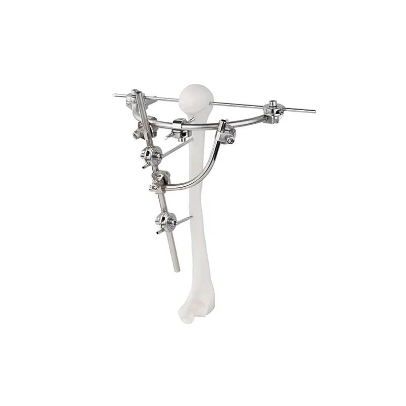 humeral condylar external fixator