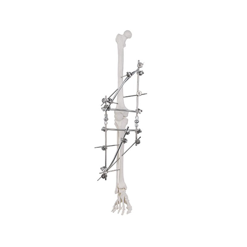 knee joint external fixator 9100 2701