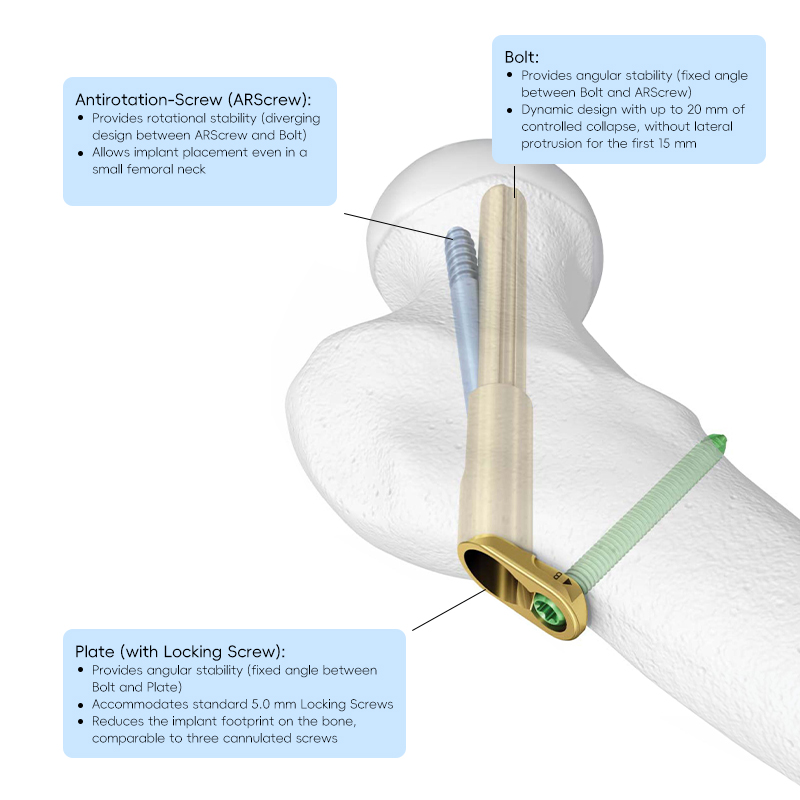 fns femoral neck system
