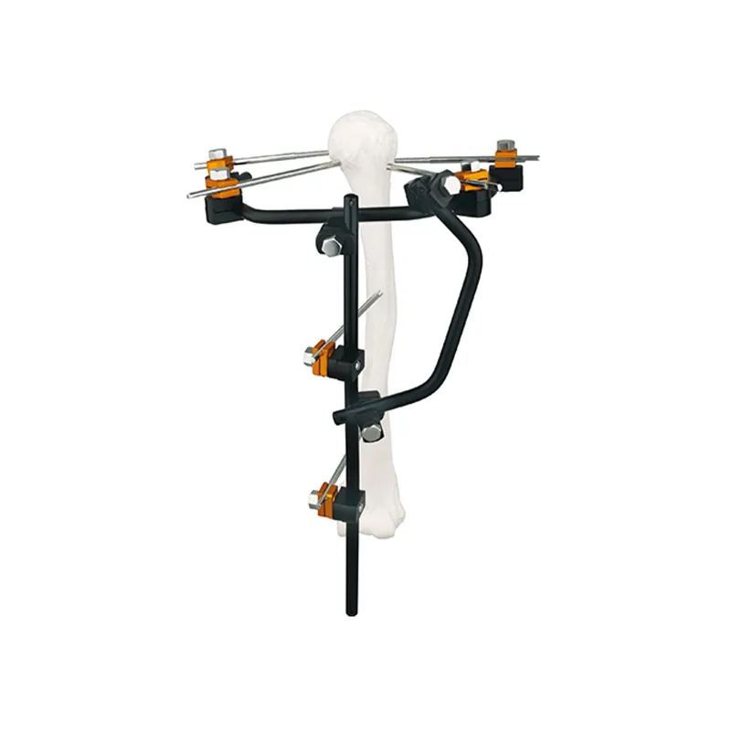 condylar external fixator