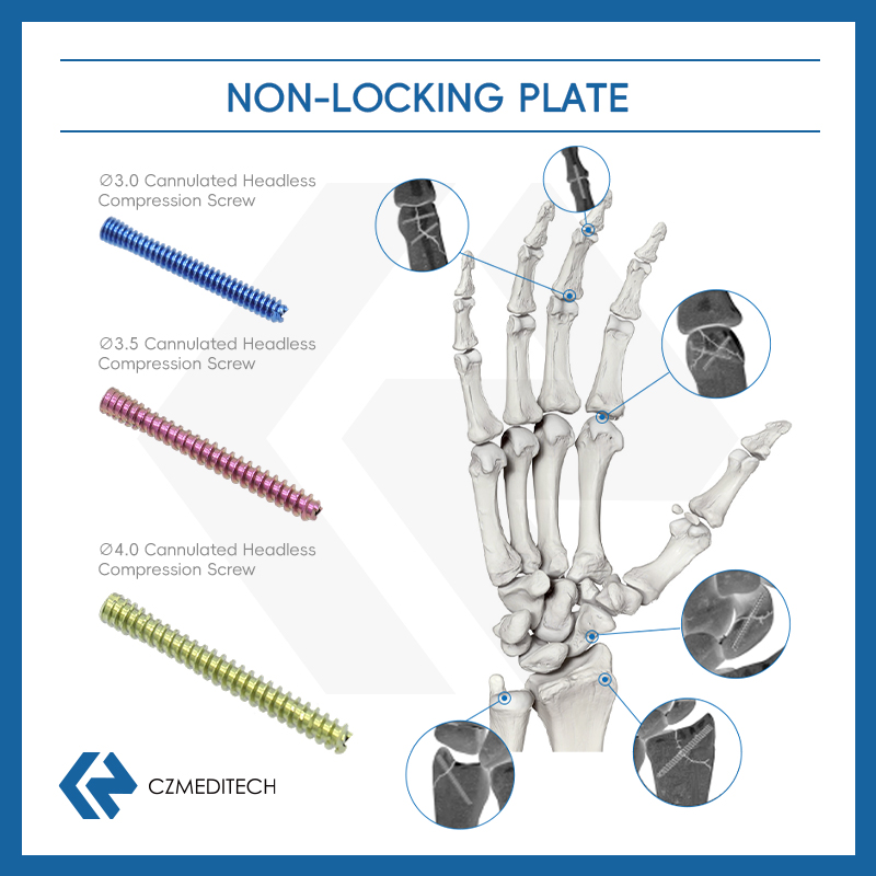 herbert cannulated compression screw