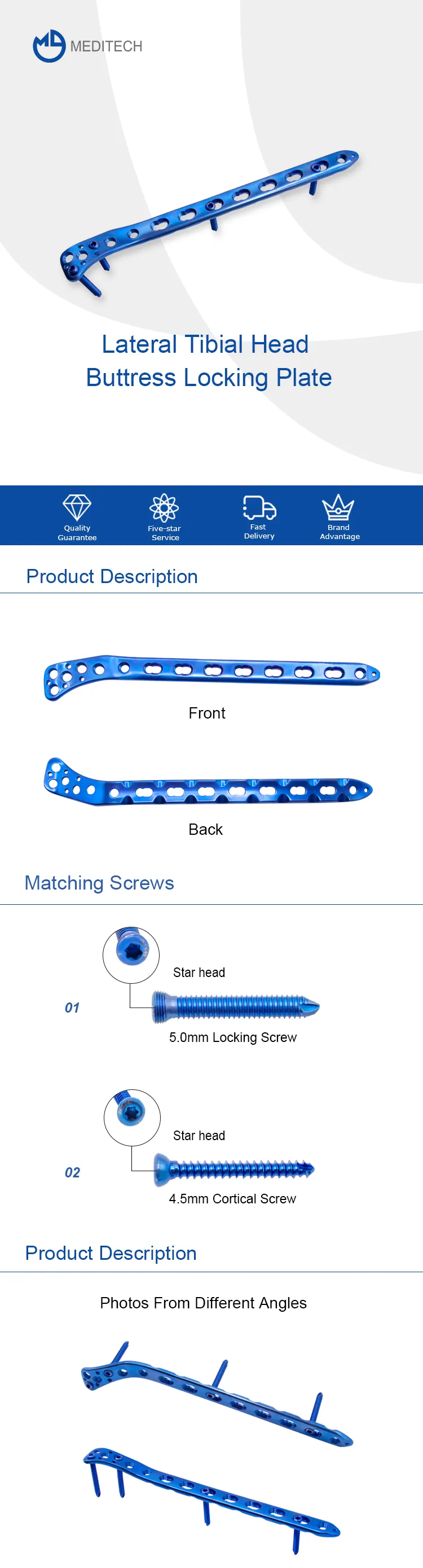 lateral tibial head buttress locking plate