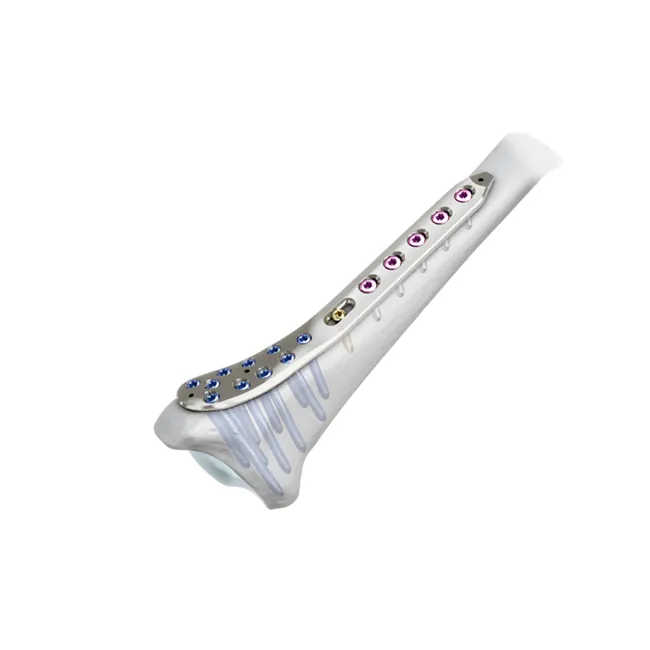 distal medial tibial locking plate ii