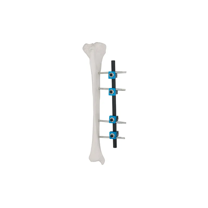 straight type external fixator 8100 14