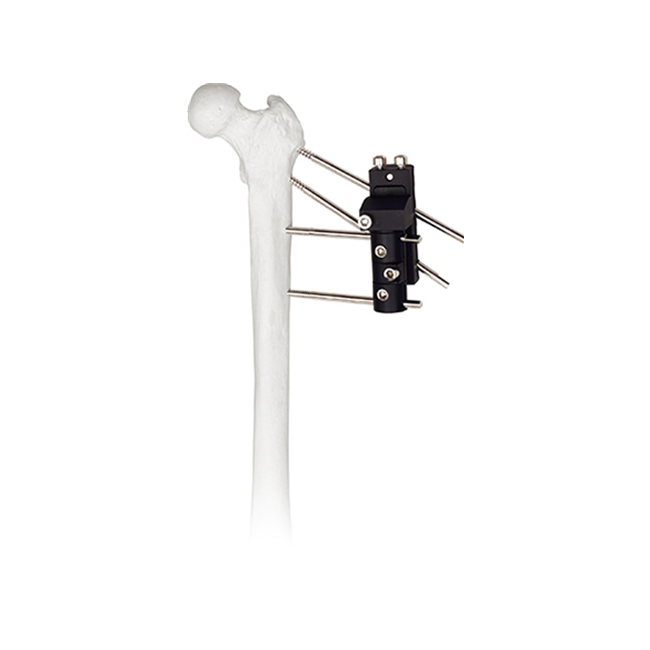 dynamic axial hip joint traction external fixator