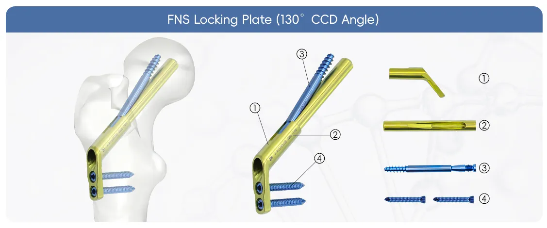 fns femoral neck system