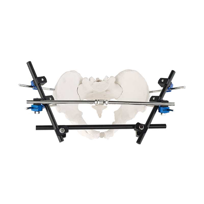 pelvic fixator external fixator