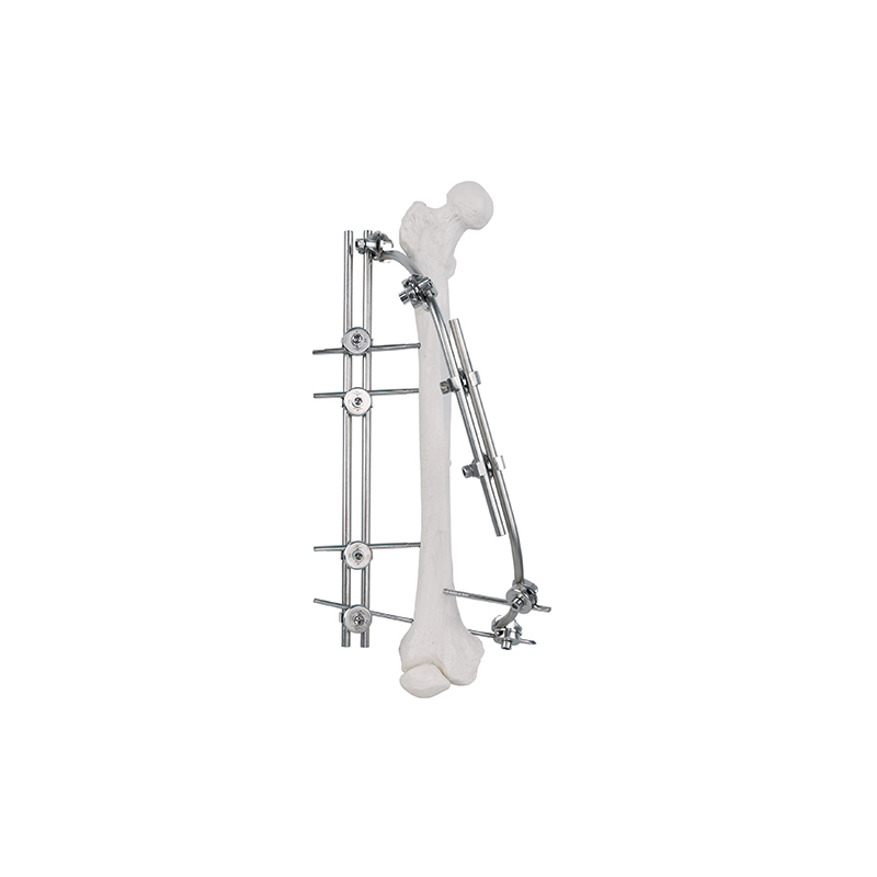 femoral shaft external fixator 9100 2301