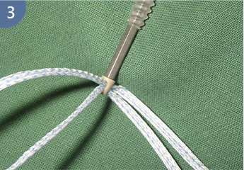 polyethylene suture ethicon suture