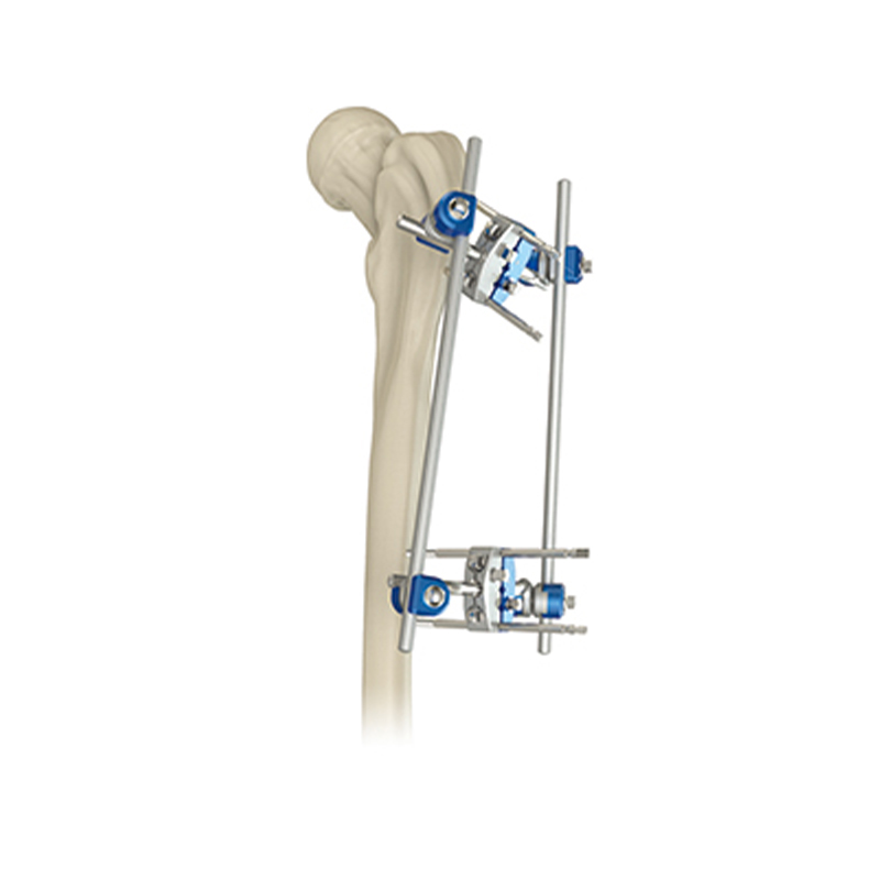 proximal femur external fixator