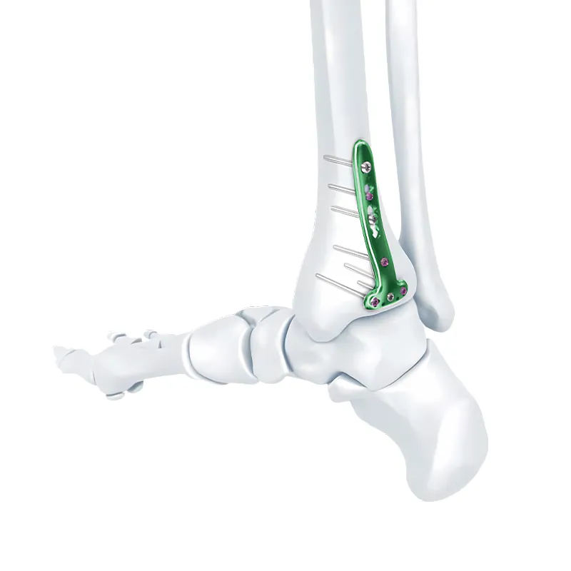 va distal tibia locking t plate