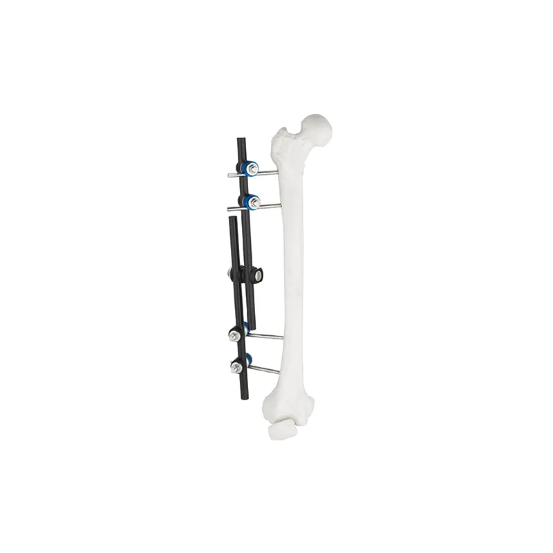 straight type external fixator 8100 10