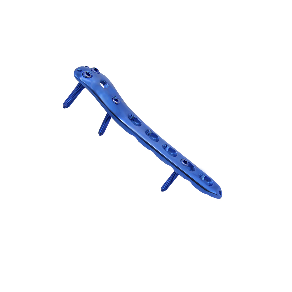 proximal femoral locking plate i