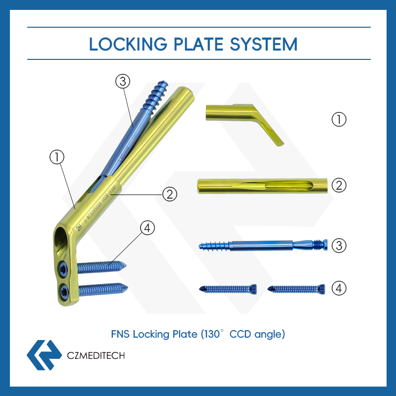 fns femoral neck system