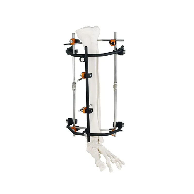 half ring type external fixator