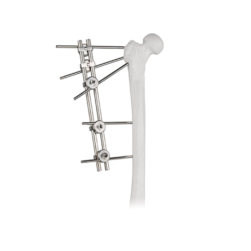 double rods tuberosity external fixator