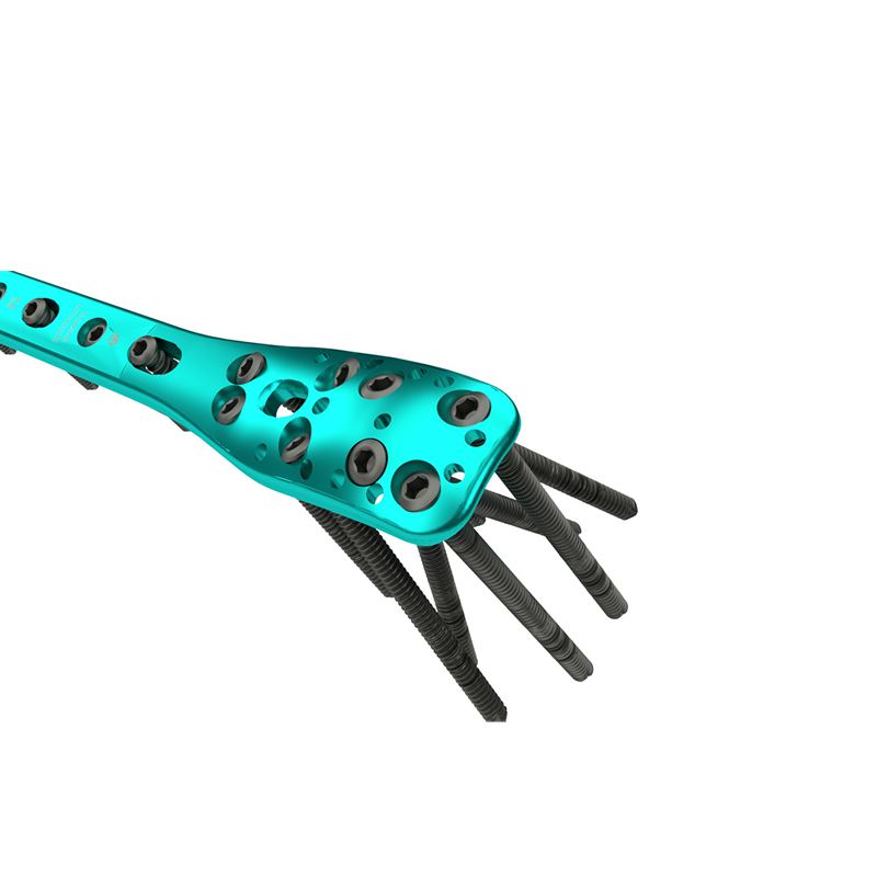 proximal humeral locking plate