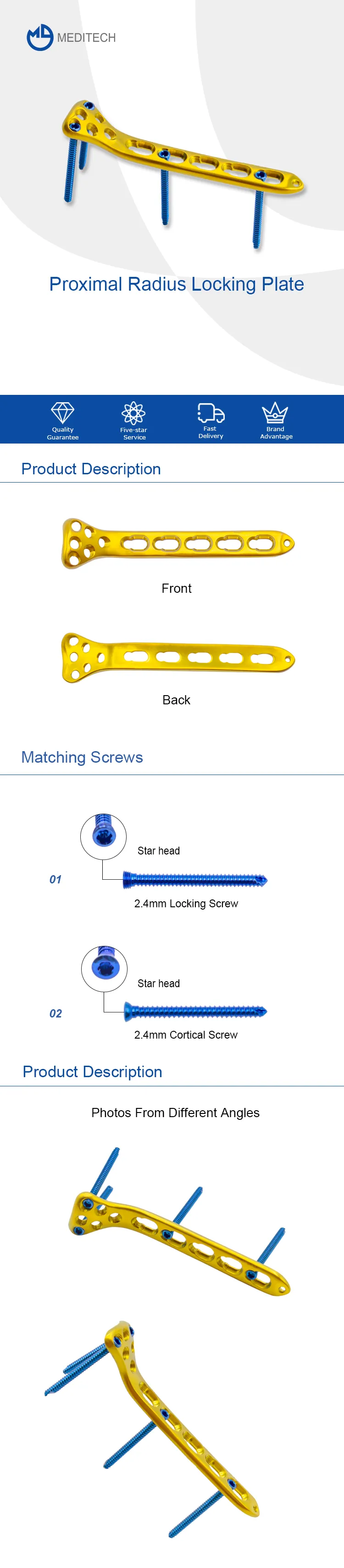 proximal radius locking plate