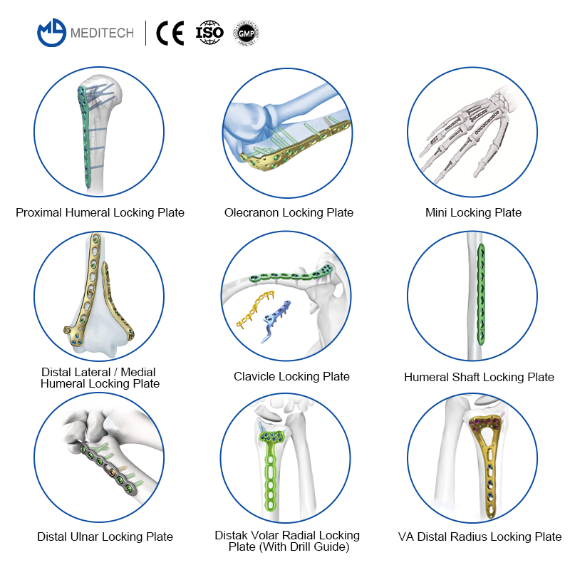 2 4mm cortex screw
