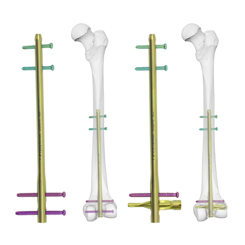 dfn distal femur intramedullary nail t1100 46
