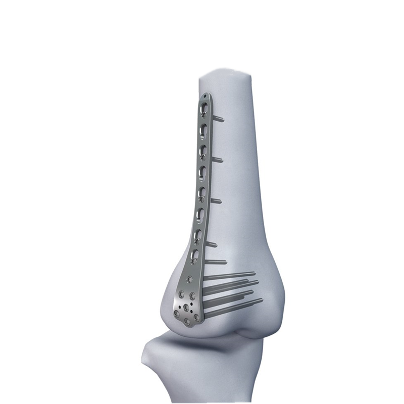 distal femoral locking plate